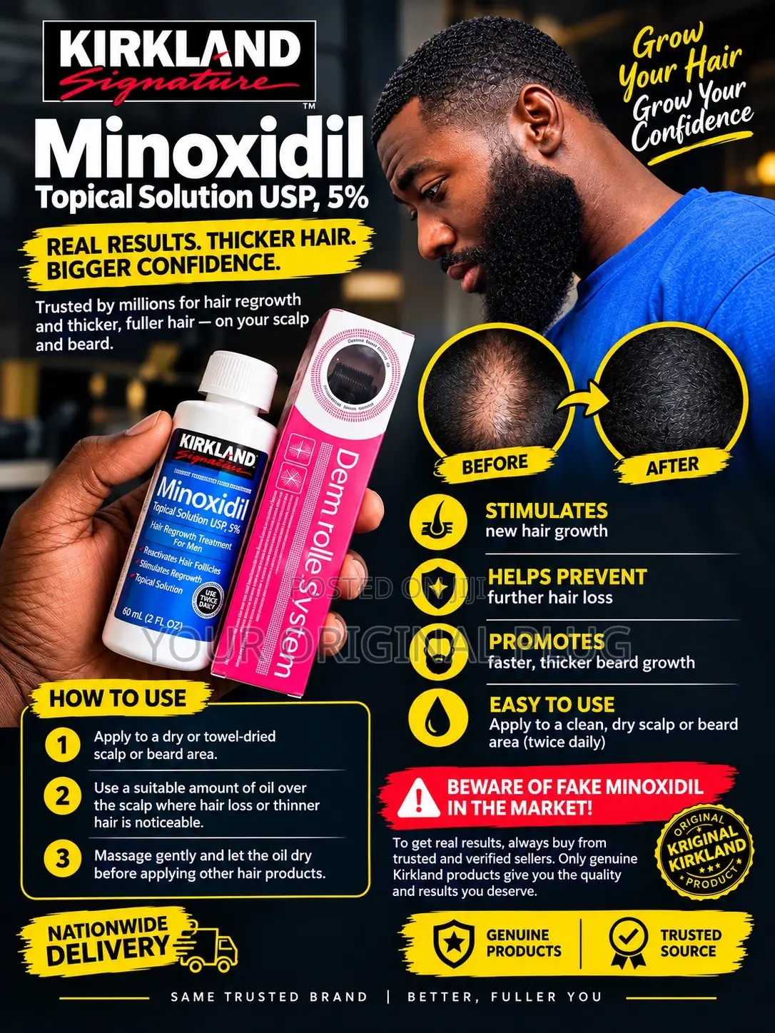 Kirkland Minoxidil 5% Extra Strength + Derma Roller, Hair Growth Combo