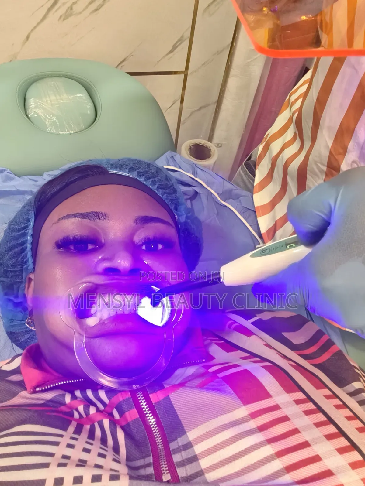 Professional Teeth Whitening 