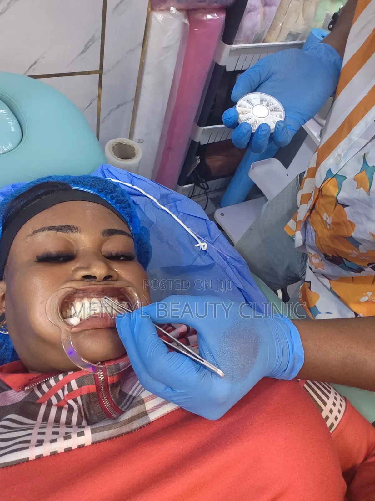 Professional Teeth Whitening 