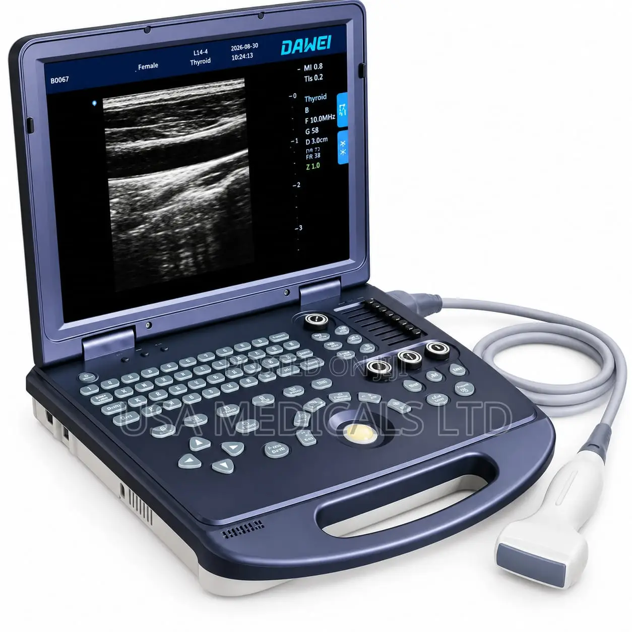 Ultrasound Scan Trolley With Probe(DAWEI)
