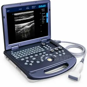 Ultrasound Scan Trolley With Probe(DAWEI)