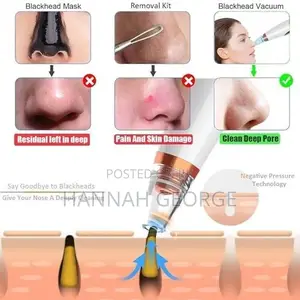 Acne Pimple Vacuum