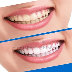 Instant Teeth Whitening Strips
