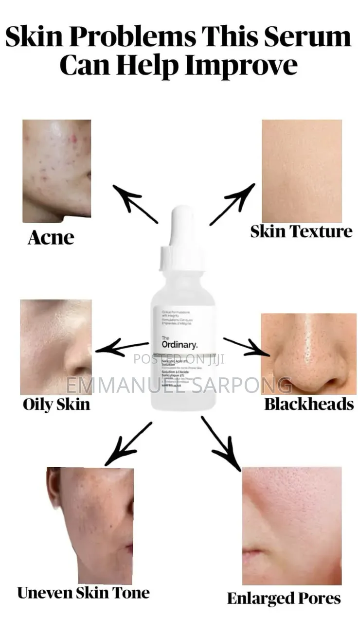 The Ordinary Salicylic Acid 2% Serum