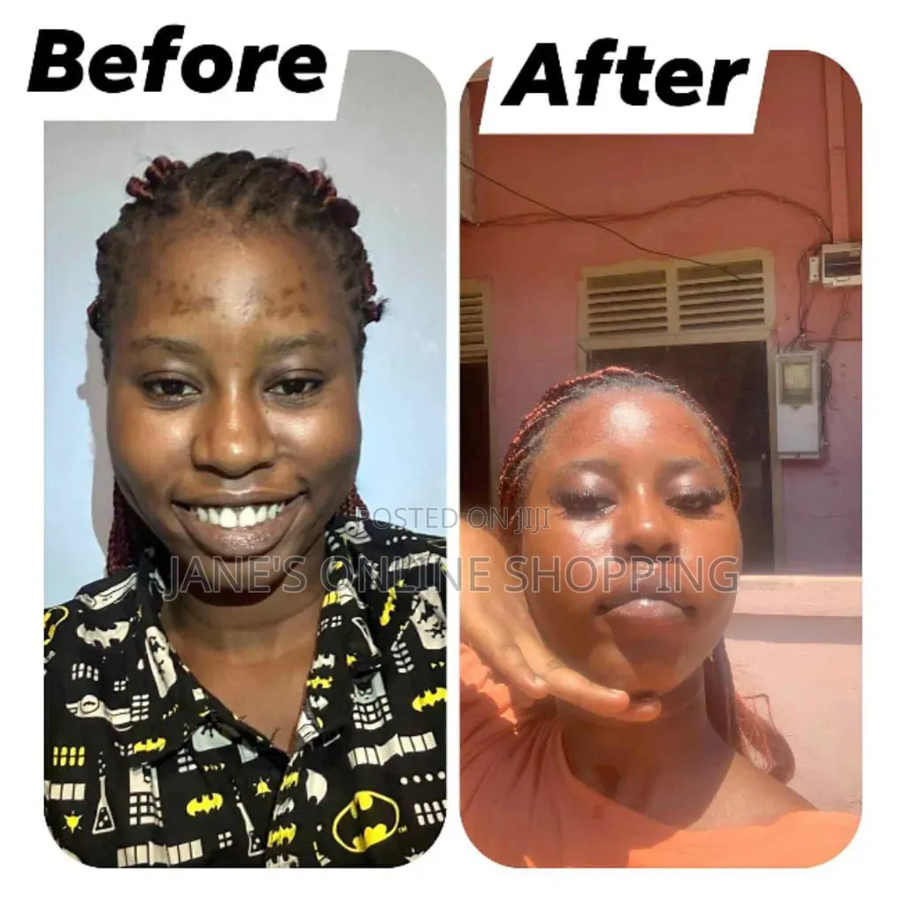 Treatment Soap