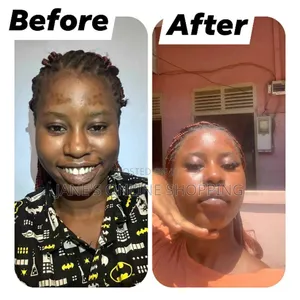 Treatment Soap