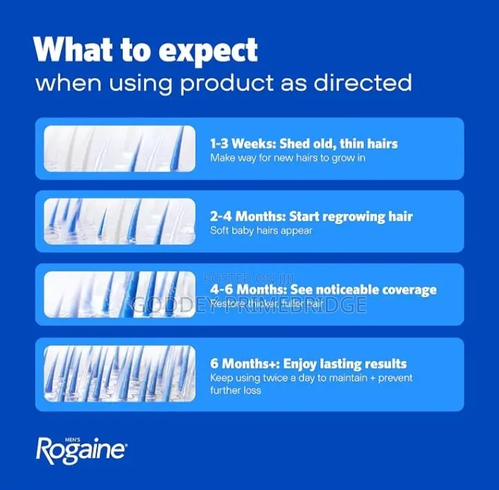 Rogaine Hair Growth-Original 3pcs