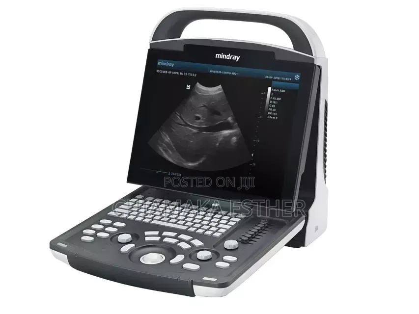Dp 10 Mindray Scan Machine