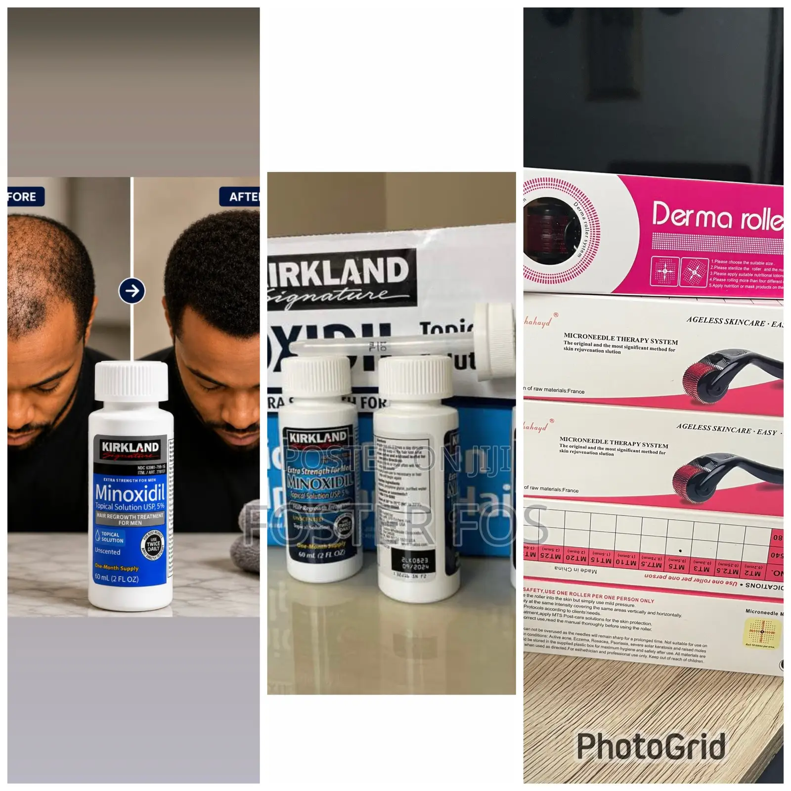 Kirkland Minoxidil and Derma Roller