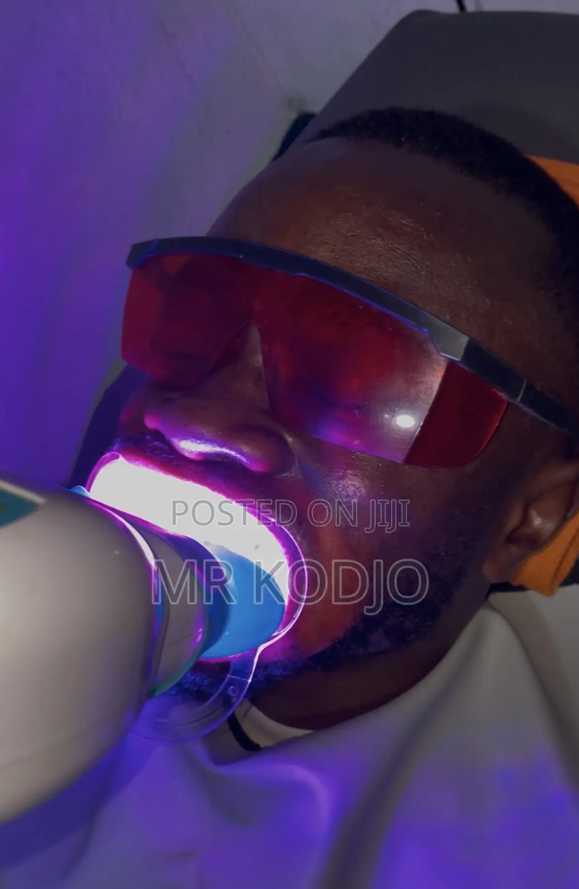Teeth Whitening Service