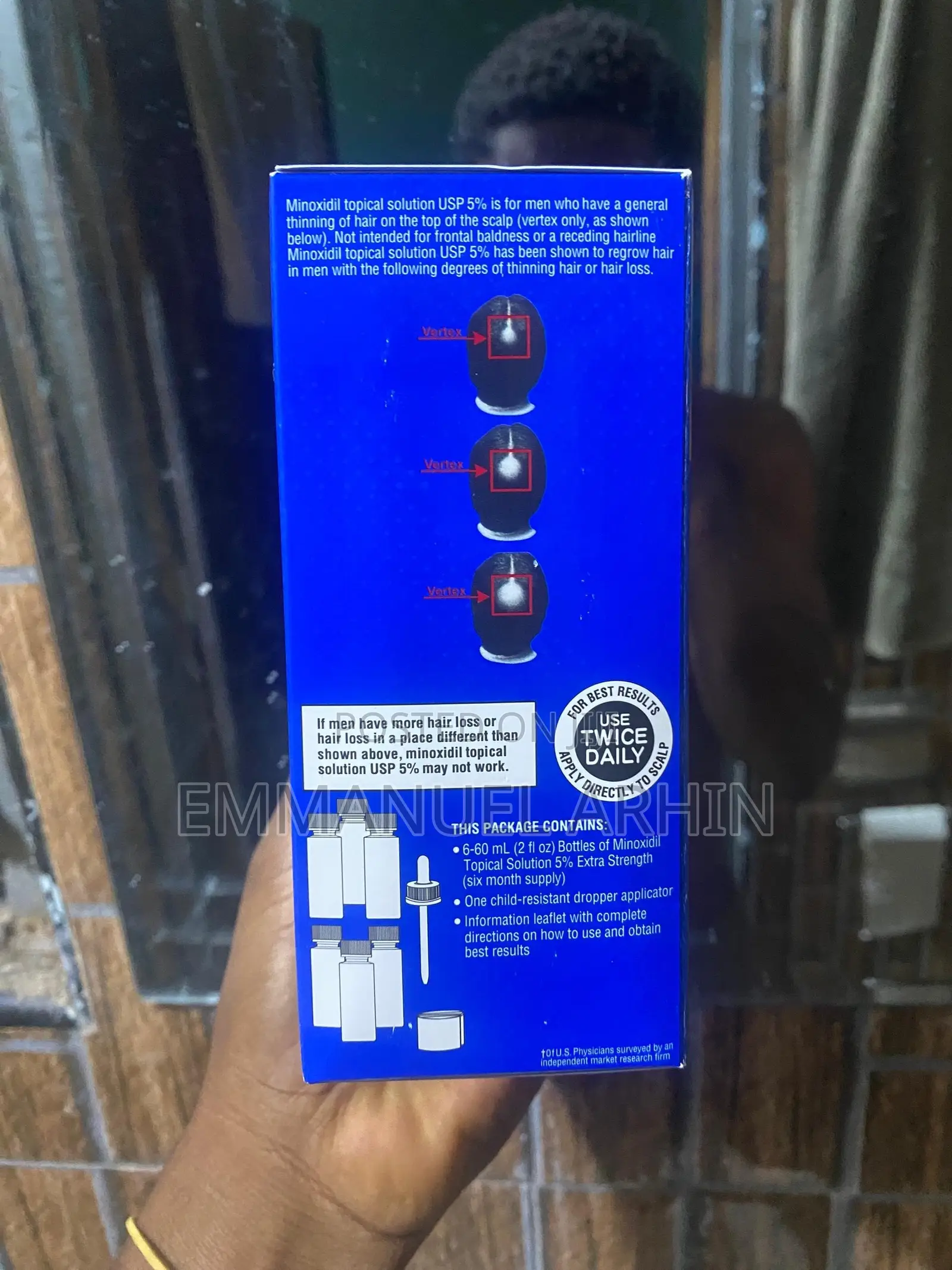 5% Kirkland Minoxidil