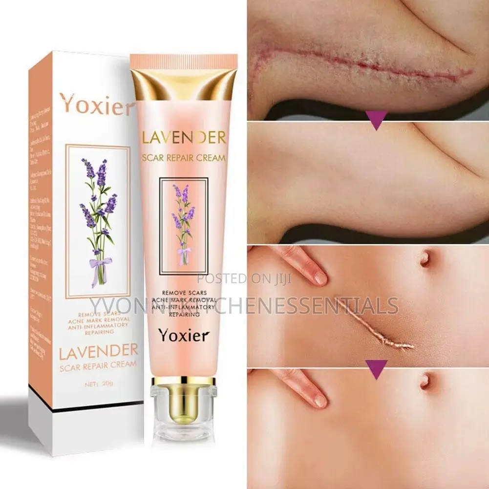 Yoxier Lavender Scar Removal Cream