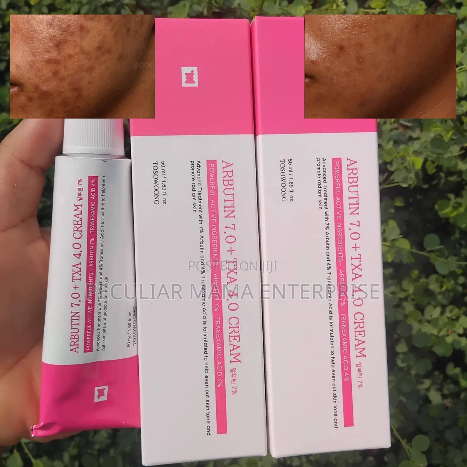Tosowoong Arbutin 7.0 + TXA 4.0 Cream