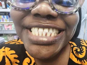 Fashion Braces Available Book Appointment