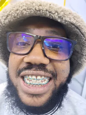 Fashion Braces Available Book Appointment