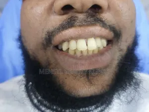 Fashion Braces Available Book Appointment