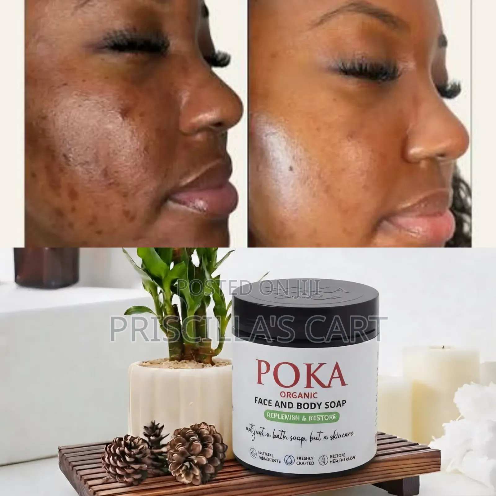 Poka Glow Soap and Body Butter ( NO BLEACHING )