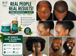 Hair and Beard Growth Cream and Oil