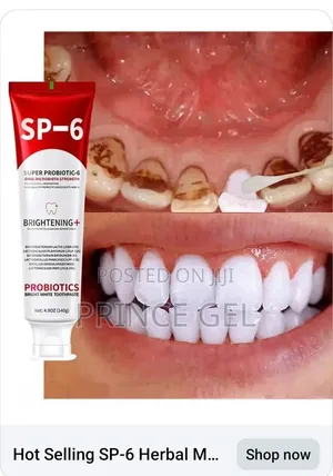 Halitosis Paste to Keep Your Teeth and Mouth Healthy
