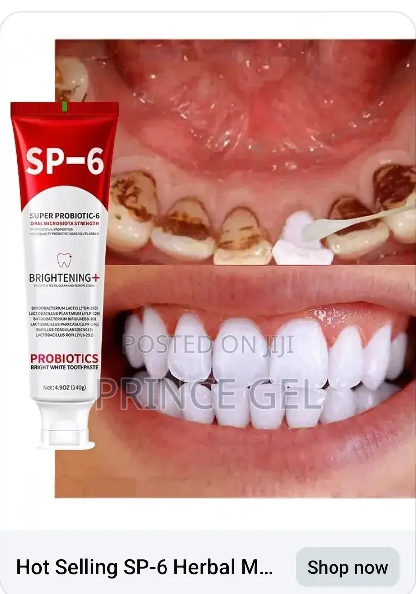 Halitosis Paste to Keep Your Teeth and Mouth Healthy