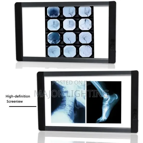 X-Ray View Box Double