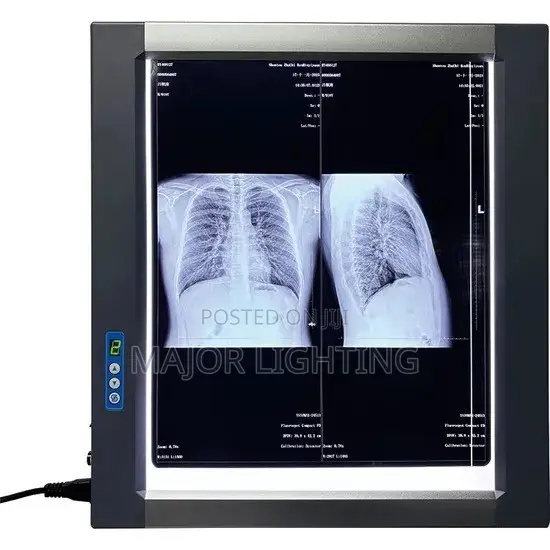 X-Ray View Box Double