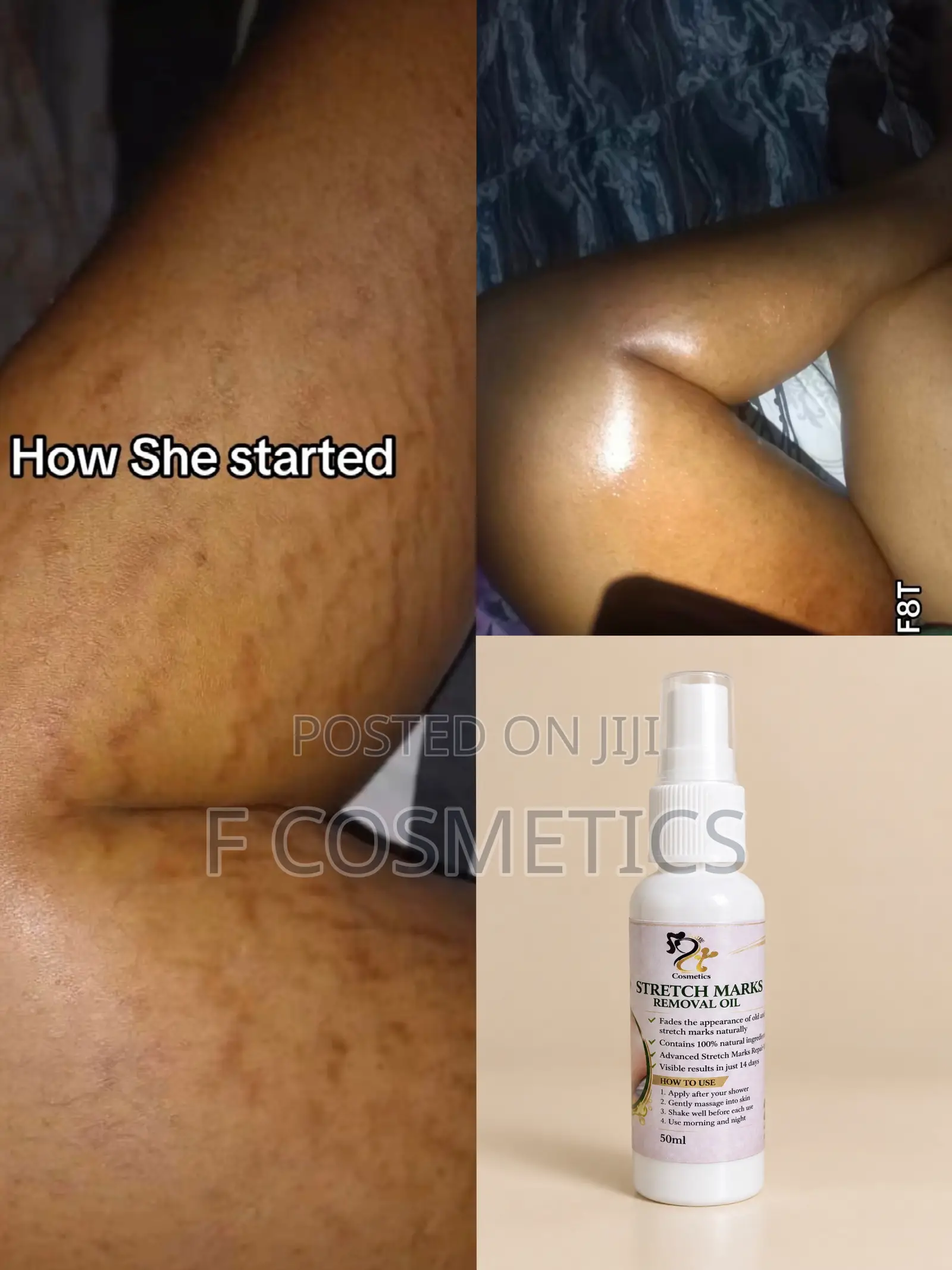 Stretchmarks Oil