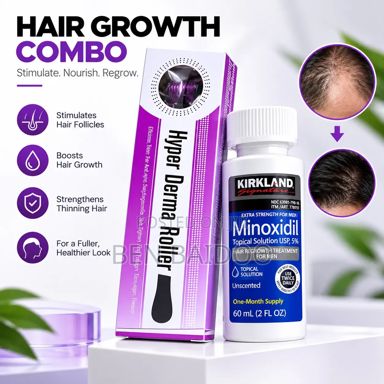 Kirkland Minoxidil & Derma Roller (Hair Strengthener)