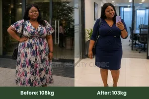 Weight Loss Medicine / Injection 15mg